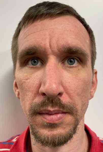 HUTCHISON, ANTHONY EDLOW