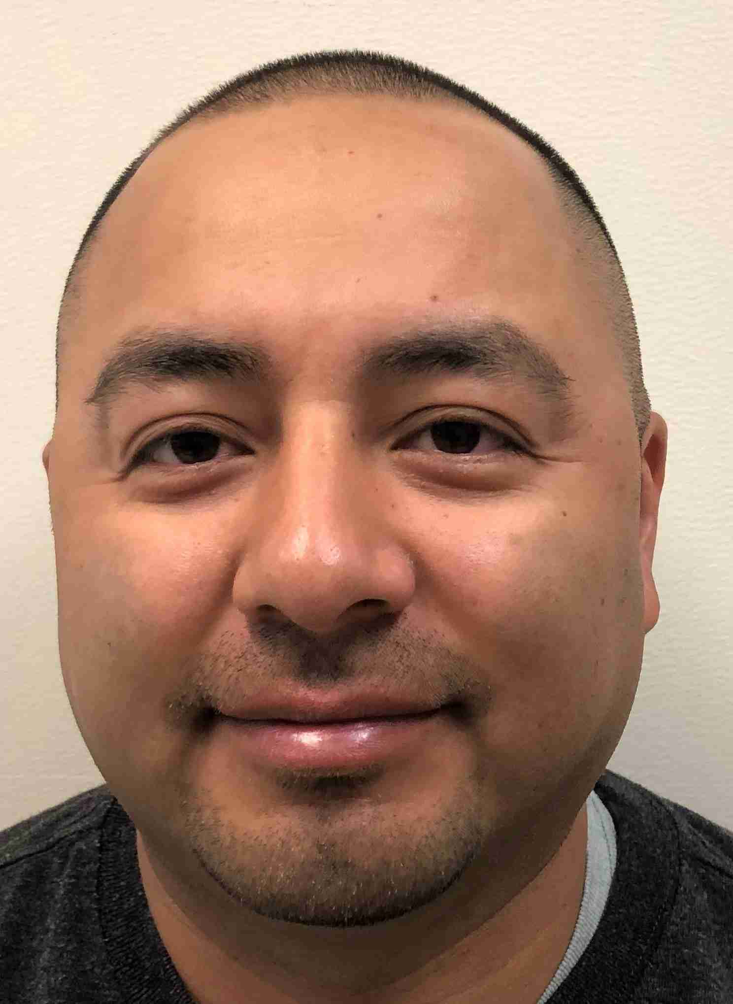 NUNEZ, JUAN D