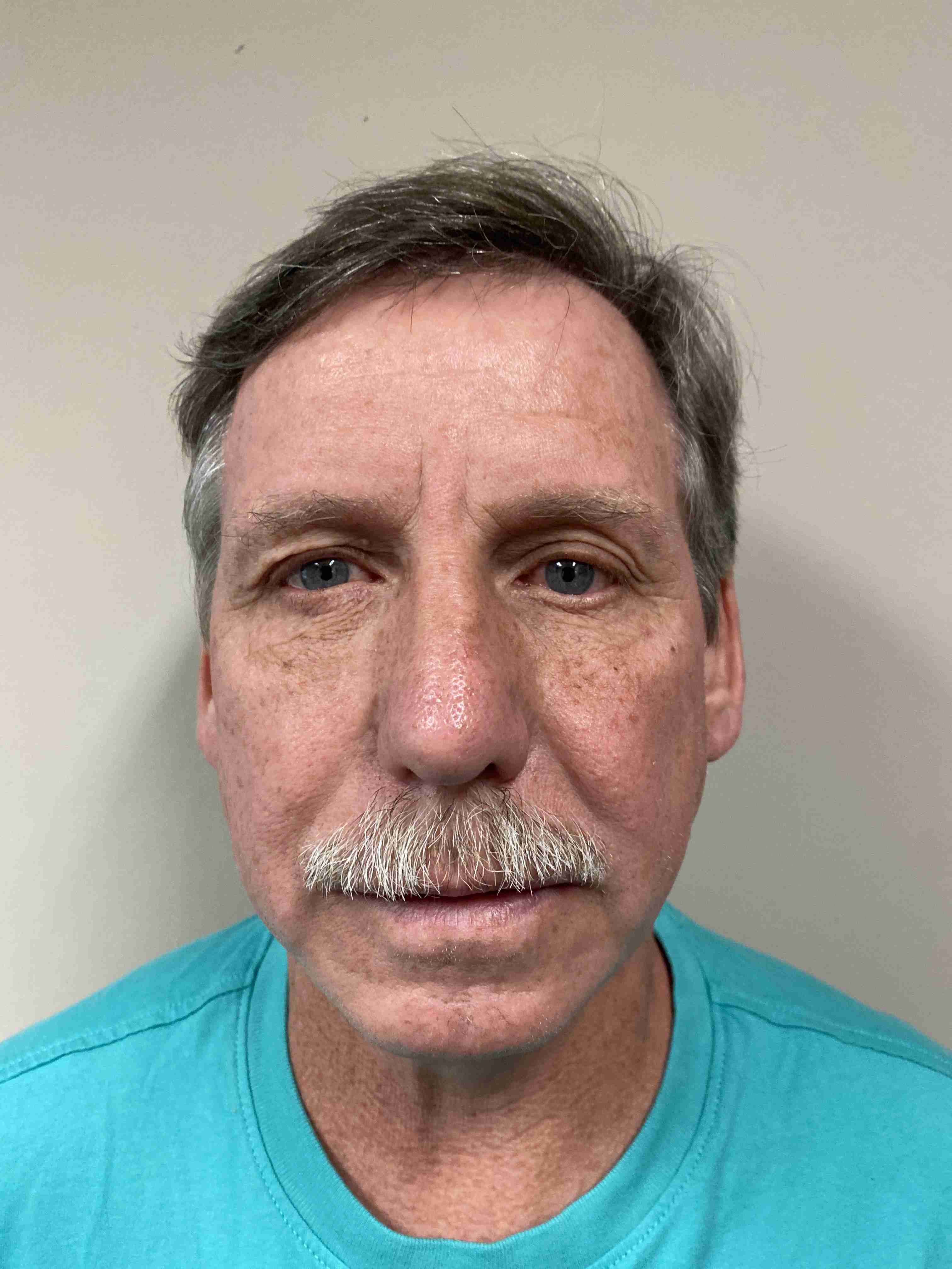 STOOPS, ANDREW HAROLD