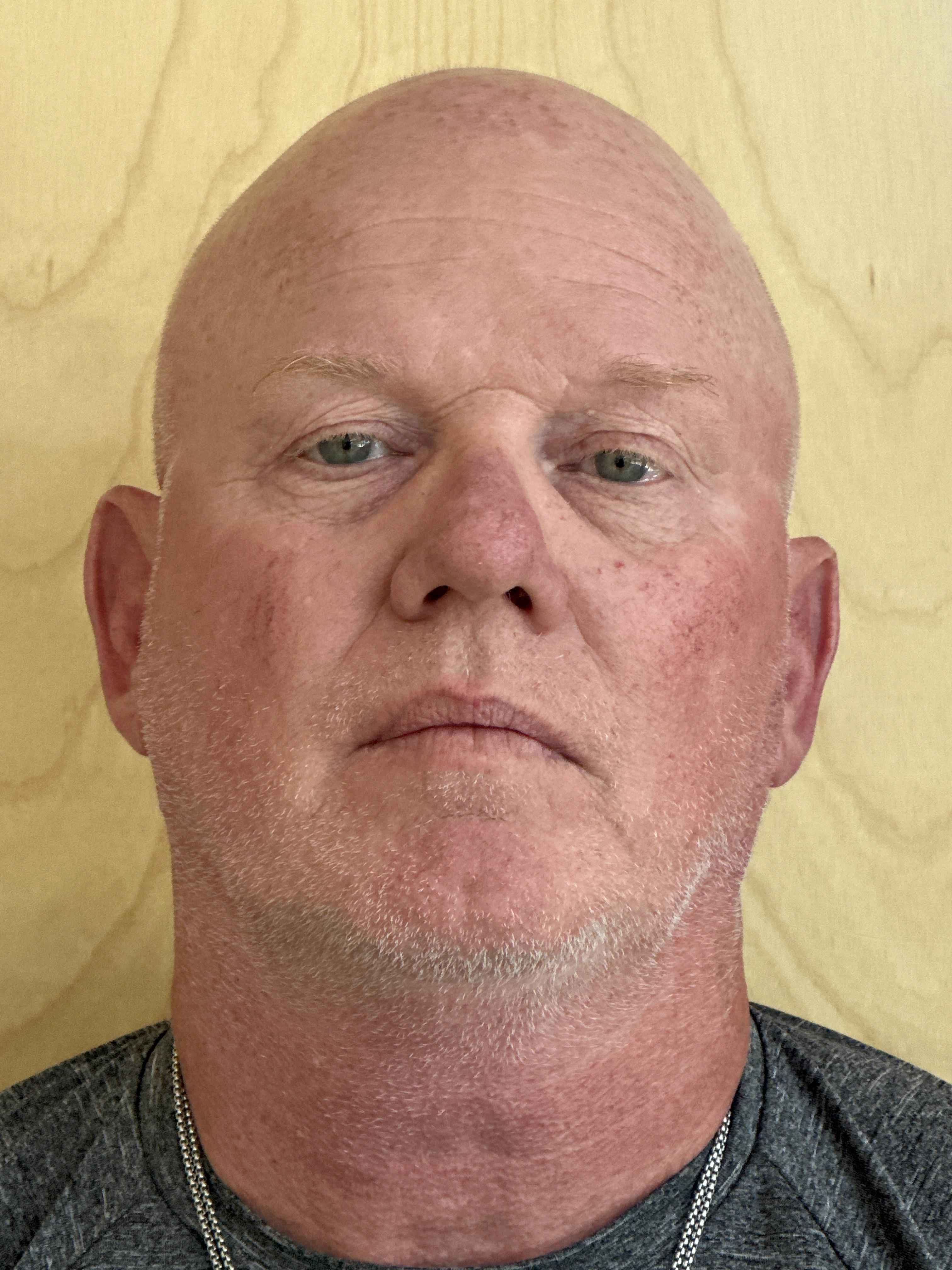 LANDE, PHILLIP ANTHONY