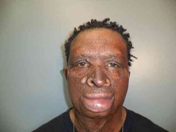 BENNETT, MELVIN JAMES