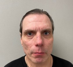 FORBIS, ANDREW