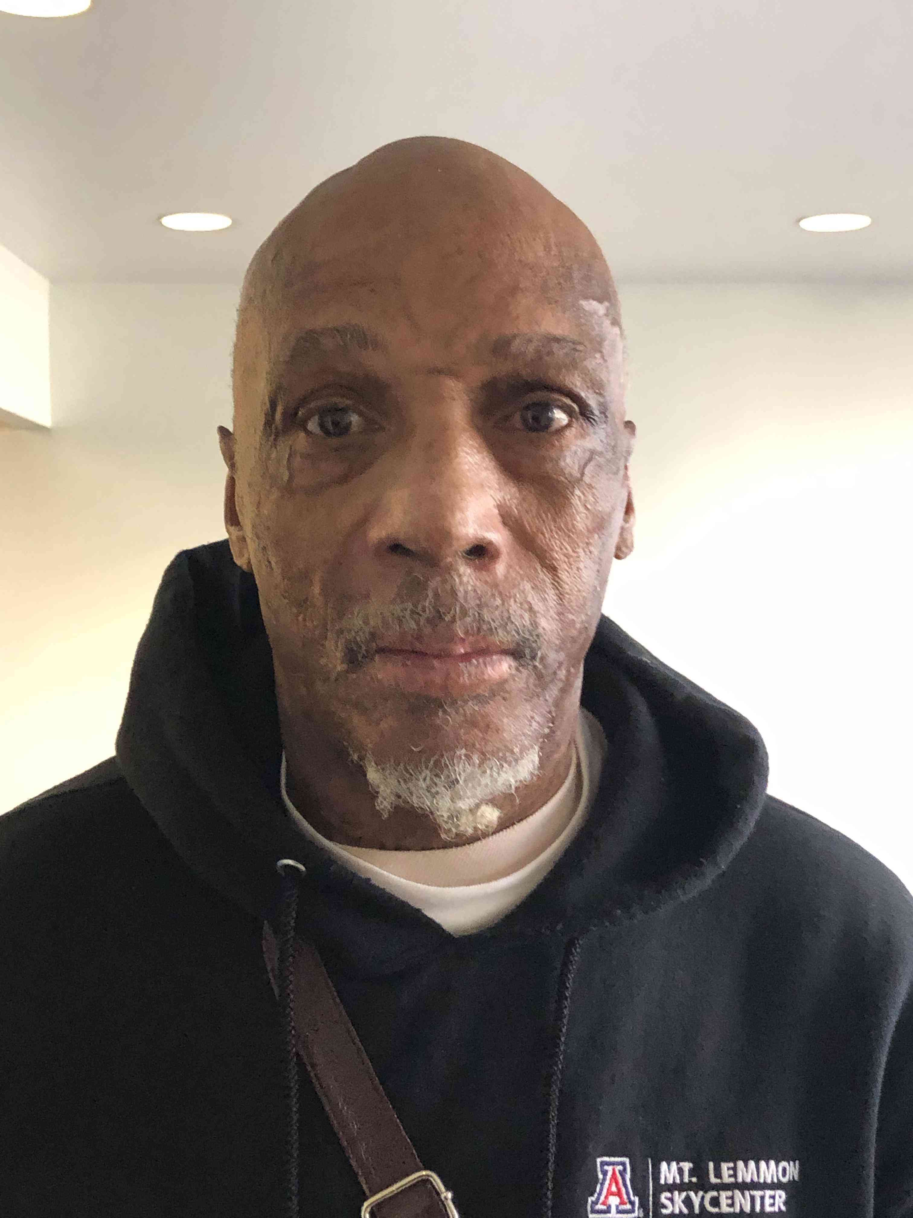ADDISON, LARRY D.
