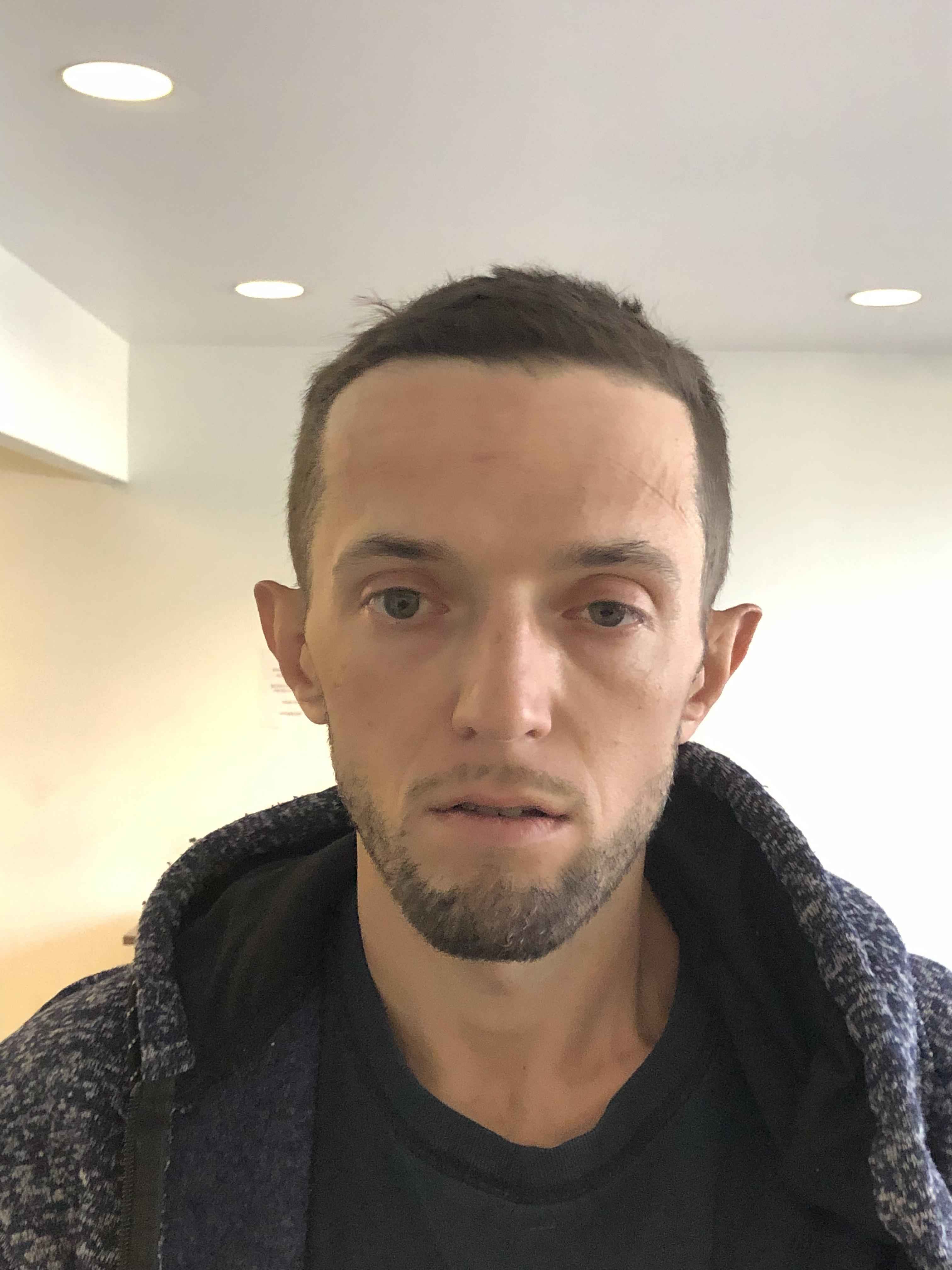 BECKER, JAMES M