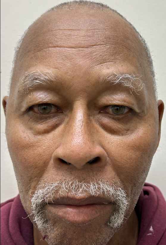 BENJAMIN, ALBERT LEE