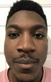 DIXON, THAI BAESHAWN