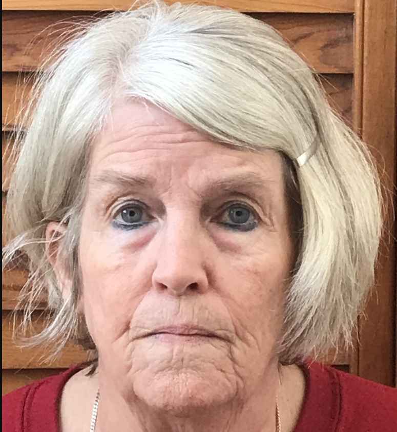 BURROWS, MARGARET DOUGLAS