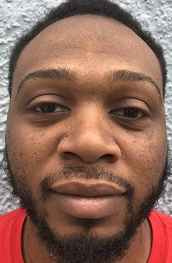 ATTIDORE, MARC ALEXANDER