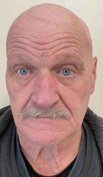 BLUM, MICHAEL THOMAS