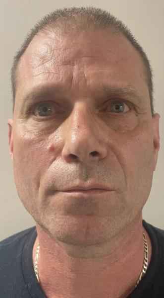 ALBERT, SCOTT HAROLD